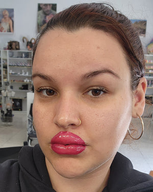 Prótesis de labios #1 silicona encapsulada